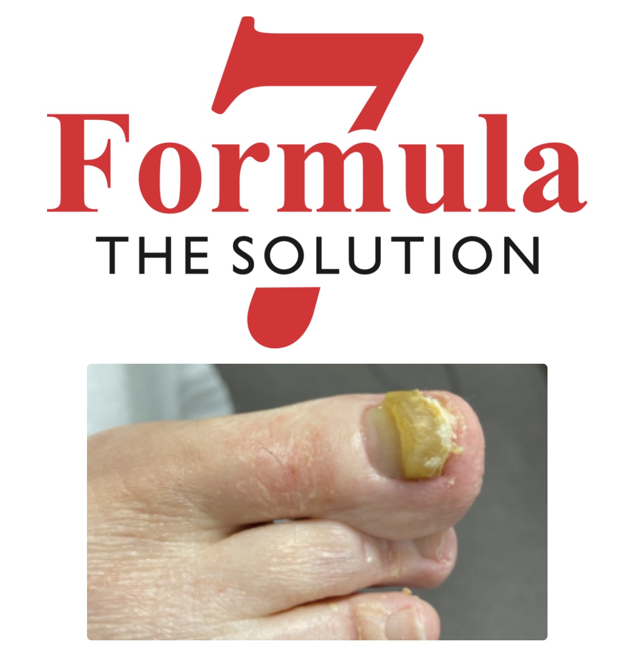 nail formula 7